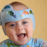 Image of a baby wearing a cranial molding helmet